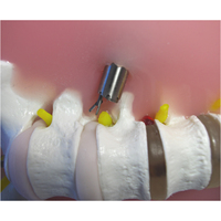 Modèle d'enseignement médical pour la simulation d'endoscopie du foramen intervertébral