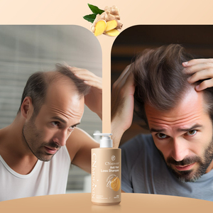 Crème biologique <span class=keywords><strong>anti</strong></span>-chute de cheveux au gingembre pour la <span class=keywords><strong>calvitie</strong></span>, croissance des cheveux, <span class=keywords><strong>anti</strong></span>-pelliculaire, nourrissante, hommes et femmes, formule 2 en 1, sans sulfate - Product Image 4