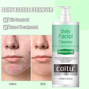 Yağ Kontrolü Sağlayan Akne Giderici Jel Yüz Temizleyici Niacinamide Purslane Kokulu Büyük Boy Aydınlatıcı Nemlendirici Hafif - Product Image 1