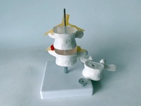 Modelo de Hernia Discal Lumbar Humana con Vértebras Desmontables para Quiroprácticos, Modelo de Columna Espinal de 3 Vértebras, CE/ISO