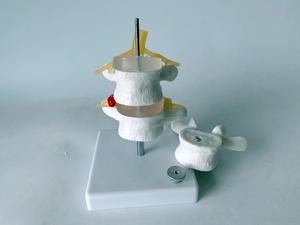 Model herniasi Lumbar manusia kolom tulang belakang vertebra dapat dilepas untuk chiropractor 3 Model vertebra - Product Image 2