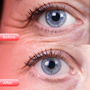 Dispositivo de Cuidado Ocular Kaiyan, Máscara de Terapia de Luz Roja para Ojeras, Hinchazón, Ojos Cansados, Eliminador de Arrugas, Enchufe Estadounidense - Product Image 6