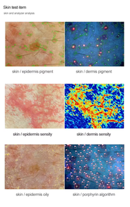 Analizador de Piel y Cuero Cabelludo Todo en Uno con IA, Detector Inteligente de Microecología del Cuero Cabelludo y Folículos Pilosos - Product Image 4