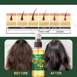 <span class=keywords><strong>Spray</strong></span> de soin capillaire au gingembre biologique Luxfume, huile de croissance capillaire anti-chute, brume nourrissante pour la <span class=keywords><strong>repousse</strong></span> des <span class=keywords><strong>cheveux</strong></span> au gingembre - Product Image 2