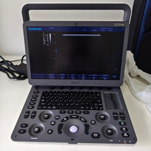 Máquina de Ecografía Doppler a Color SonoScape E2pro, Ecógrafo Portátil E2, Ultrasonido Portátil - Product Image 1