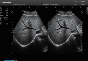 Sonosbape P12 elite ecografo doppler, sistem diagnostik <span class=keywords><strong>ultrasound</strong></span> digital dengan panduan transduser biopsi, peralatan rumah sakit - Product Image 6