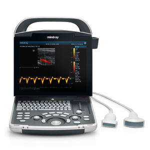 Sistema de Ultrasonido Veterinario Doppler Color 4D Mindray DP-30 Vet, Dispositivo de Imagenología de Diagnóstico de Alta Resolución para Hospital de Animales - Product Image 1