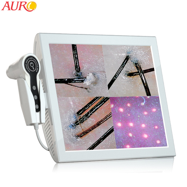 Auro Portable Salon Skin and Hair Analyzer/ Hair Scalp Scanner/ Scalp and Hair Analysis Machine