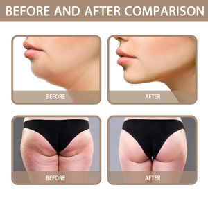 Masque chauffant au gingembre South Moon pour resserrer le double <span class=keywords><strong>menton</strong></span>, affiner le ventre et le abdomen, crème gel liftante et remodelante pour le corps - Product Image 6