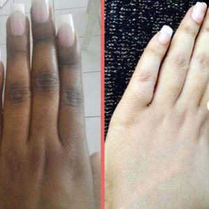 Crème Éclaircissante Puissante d'Usine pour la Zone du Bikini, Crème pour Femme pour Éliminer les Taches Sombres des Parties Intimes, Crème Blanchissante Neige pour Visage et Corps - Product Image 2