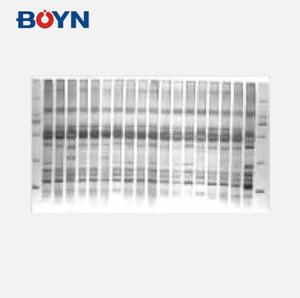BNFIS-A 시리즈 자동 젤 영상 분석 시스템 형광/화학 발광 문서 실험실 영상 시스템 - Product Image 6