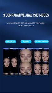 ระบบวิเคราะห์ผิวหน้า 3 มิติ ด้วย AI อัจฉริยะ สำหรับการตรวจสอบรูขุมขน ริ้วรอย เนื้อผิว ความชุ่มชื้น และความเสื่อมสภาพของผิว สำหรับการดูแลผิวอย่างแม่นยำที่บ้านและคลินิก - Product Image 6