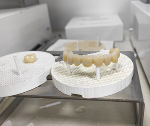 فرن سيراميك PHOENIX-9C لمختبر الأسنان، فرن تلبيد للسيراميك الزجاجي والزركونيا، درجة حرارة قصوى 1530 درجة مئوية، قدرة تسخين 1.6 كيلوواط - Product Image 6