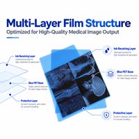 Film Thermal X-Ray Inkjet Medis 14*17, Film Biru X-Ray untuk Printer Inkjet Radiologi Medis