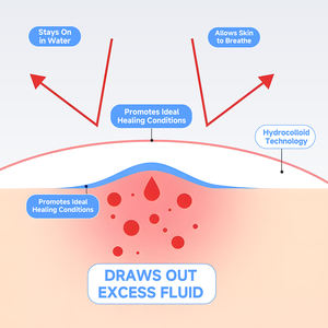 お手頃価格のハイドロコロイドニキビパッチ、工場直販、あらゆる年齢層に適しています - Product Image 5