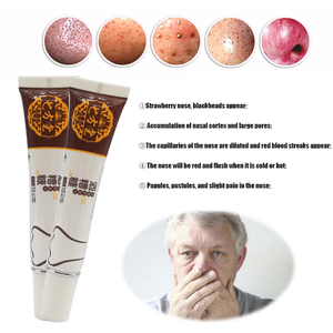 Unguento a Base di Erbe Cinesi che Inibisce i Batteri per Allergie Cutanee, Purifica il Viso, Cura Personale, Crema Antibatterica - Product Image 3