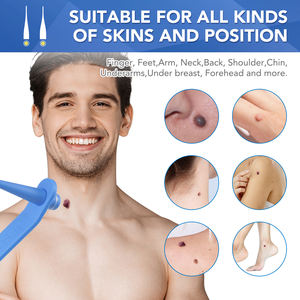 SEFUDUN Kit Rimozione Rapida Automatica di Fibromi Cutanei, Verruche e Nei da 1-4mm, Strumento per la Rimozione di Micro Fibromi Cutanei, Etichetta Privata - Product Image 2