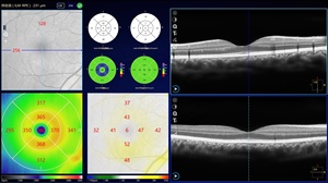Système d'imagerie OCTA ophtalmique Velite C800B avec biométrie, <span class=keywords><strong>angiographie</strong></span> CSLO, diagnostic de la rétine, système d'examen optique de l'œil - Product Image 3