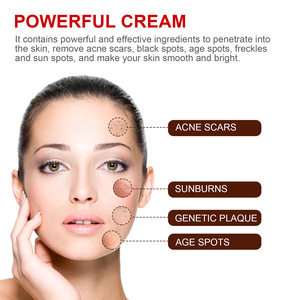 Crema Hidratante Facial Nocturna Blanqueadora para Niños con Vitamina C y Aloe Vera para Aclarar Manchas, Reducir Melanina, Iluminar, Hidratar y Reparar - Product Image 4