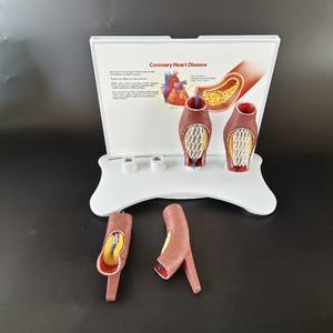 Учебные материалы по медицинским наукам: Стенты для лечения сердечно-сосудистых и цереброваскулярных заболеваний, атеросклероза - Product Image 4