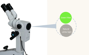 KN-2200BI điện nguồn điện xách tay quang học soi cổ tử cung cho phụ khoa âm đạo kiểm tra cổ tử cung bi loạt - Product Image 4