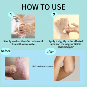 <span class=keywords><strong>Crema</strong></span> Riparatrice per la Cura del Corpo, Idratante, Contro Prurito, Micosi, Eruzioni Cutanee, Psoriasi, a Base di Erbe - Product Image 3