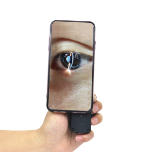 Lámpara de Hendidura Portátil para Smartphones, Ancho de Hendidura Ajustable de 0-12 mm, S150 Veterinaria, Digital, Aumento de 6X, Filtro Azul Cobalto - Product Image 1