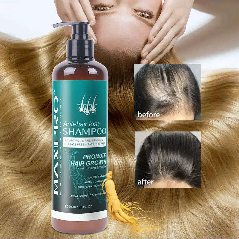 Shampooing de croissance Maxipro shampooing anti-chute de cheveux et revitalisant produits de soins capillaires empêche l'amincissement des cheveux