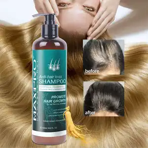 Maxipro шампунь для роста волос против выпадения волос шампунь и кондиционер для ухода за волосами предотвращает истончение волос