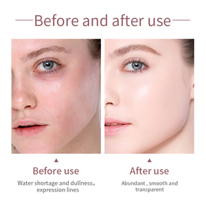 <span class=keywords><strong>2025</strong></span> Hữu Cơ Kem Dưỡng Ẩm Vẻ Đẹp Sản Phẩm Dễ Dàng Để Có Khuôn Mặt Chăm Sóc Da Kit Mặt Tăng Du Lịch Chăm Sóc Da Bộ - Product Image 5