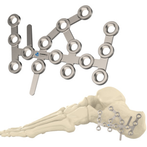 Plaque de blocage en titane CANWELL pour le calcaneeuse, implant orthopédique pour traumatismes du pied <span class=keywords><strong>et</strong></span> de la <span class=keywords><strong>cheville</strong></span>, chirurgie des fractures, CE ISO - Product Image 1