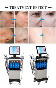 2024 14 in 1 Beauty Skin System OEM ODM Microdermabrasion Aqua Peel Machine EU/US/CN Plug Facial Care for Eyes - Product Image 2