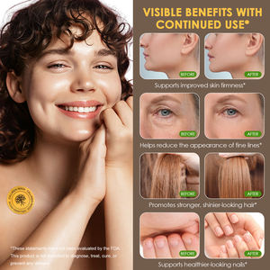 Acentiallabs 30 ספירת ויטמינים קולגן תוספת עור טלאי עור עמידות גמישות טלאים קולגן לנשים - Product Image 3