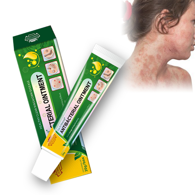 Factory Sales Natural Chinese Herbal Eczema Cream Psoriasis Dermatitis Ointment Antipruritic Cream