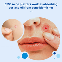 Patchs Hydrocolloïdes Anti-Acné en Forme d'Étoile avec Boîte Miroir, Autocollants Colorés pour Boutons, Traitement Esthétique des Imperfections, Sans Cruauté Animale, Marque Privée