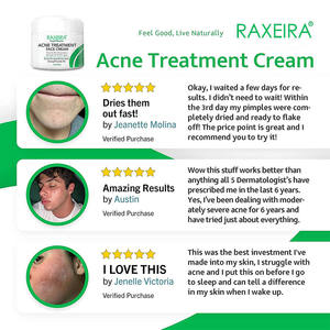 Crema Facial con Peróxido de Benzoilo Natural de Marca/Logotipo ODM - Product Image 4
