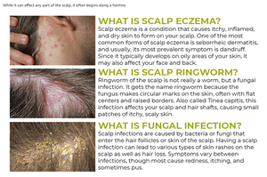 Shampooing pour hommes à l'acide salicylique, à l'huile d'arbre à thé, <span class=keywords><strong>anti</strong></span>-pelliculaire et <span class=keywords><strong>anti</strong></span>-frisottis pour le nettoyage. - Product Image 5