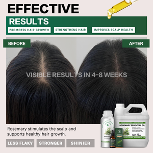 <span class=keywords><strong>Huile</strong></span> <span class=keywords><strong>Essentielle</strong></span> de <span class=keywords><strong>Romarin</strong></span> 100% Pure et Naturelle de Qualité Thérapeutique, Biologique, Fraîche, Douceur Parfumée, Soin Quotidien des Cheveux, Éclaircissante, Nourrissante, Vapeur - Product Image 2