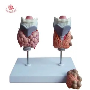Анатомическая модель высокого качества медицинская патологическая модель щитовидной железы 4 части анатомическая модель горла щитовидной железы