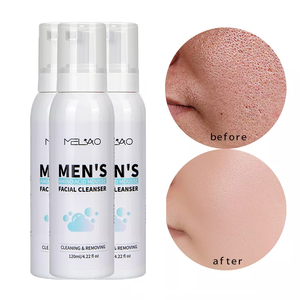 <span class=keywords><strong>Mousse</strong></span> <span class=keywords><strong>nettoyante</strong></span> <span class=keywords><strong>visage</strong></span> pour <span class=keywords><strong>homme</strong></span>, nettoyant facial naturel aux acides aminés, <span class=keywords><strong>mousse</strong></span> naturelle pour <span class=keywords><strong>homme</strong></span>, nettoyant facial végétalien à label privé - Product Image 4