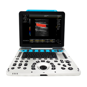 Sistema Diagnostico Veterinario a Ultrasuoni Doppler da 15 Pollici per <span class=keywords><strong>Esame</strong></span> Ostetrico di Bovini, Cavalli, Suini, Ovini, Cani e Gatti - Product Image 3