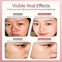 Vaporizador Facial Portátil para Uso Doméstico, Vaporizador Facial Iónico Nano, Masajeador Facial de Spa, Vaporizador Facial