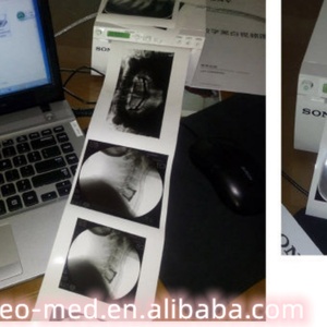 Advance Ultrasound <b>System</b> Hybrid Video Graphic Printer for Ultrasound Thermal Printer SonyUP-X898MD - Product Image 5