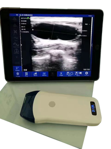 Sonda de Ultrassom Portátil Sem Fio com Array Linear, Imagem Colorida Doppler, Grau Clínico - Product Image 5