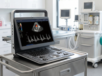 Ecógrafo Doppler Color Portátil SonoScape E2 ProV, Escáner de Ultrasonido para Veterinaria, Hospitales y Clínicas de Animales