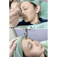 Appareil de dermabrasion au diamant professionnel pour les soins du visage en salon et spa