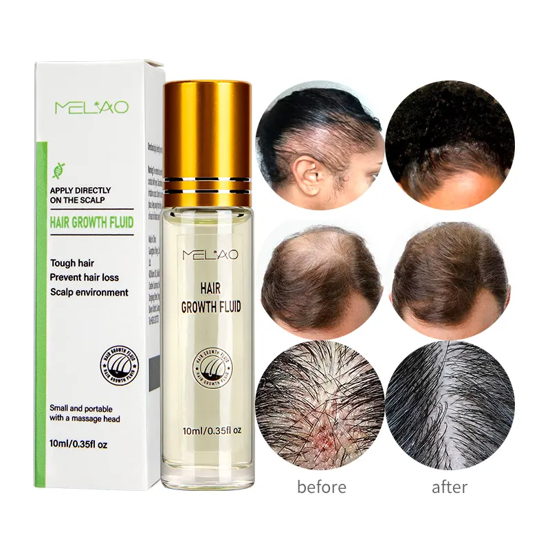 Bestes Serum für das Haar wachstum MELAO Private Label Hautpflege Anti-Aging-Hautpflege serum Vitamin C Organisches Wachstums serum für Haare