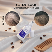 Huile capillaire sans huile pour la croissance des cheveux avec Redensyl, Capixyl, Procapil, Anagain, Niacinamide, Acides Aminés, Caféine – Protection de la densité des racines