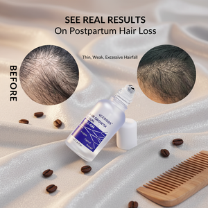 Essence de croissance capillaire sans <span class=keywords><strong>huile</strong></span> avec Redensyl, Capixyl, Procapil, Anagain, Niacinamide, Caféine pour la protection de la ligne des cheveux et de la densité capillaire - Product Image 5