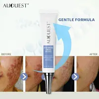 Riparazione dell'acne trattamento della pelle Anti comedone Acne cicatrice crema Gel viso